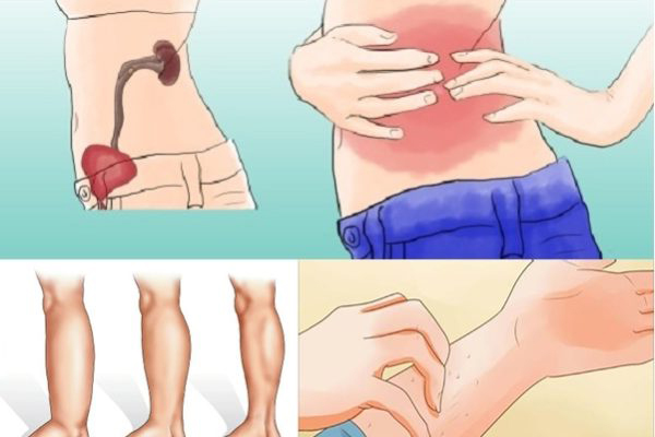 10 признаков, которые скажут, что у вас проблемы с почками 10 признаков, которые скажут, что у вас проблемы с почками