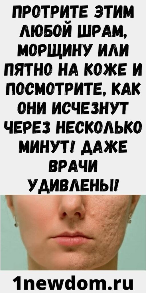 Протрите этим любой шрам, морщину или пятно на коже и посмотрите, как они исчезнут через несколько минут! Даже врачи удивлены!