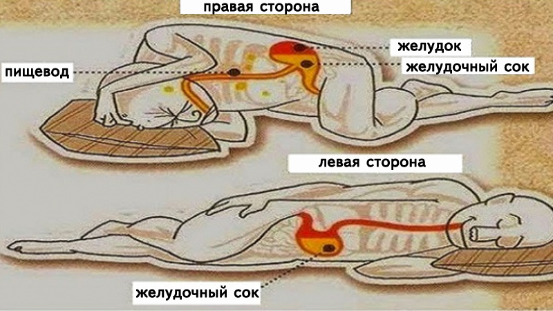 На каком боку лучше всего спать? Рекомендации врачей