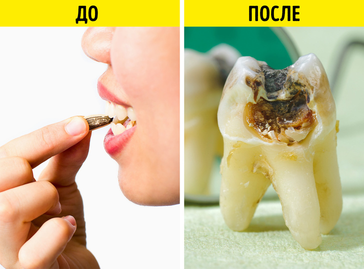 Что происходит с организмом, когда вы часто едите семечки (И правда ли, что они провоцируют аппендицит)