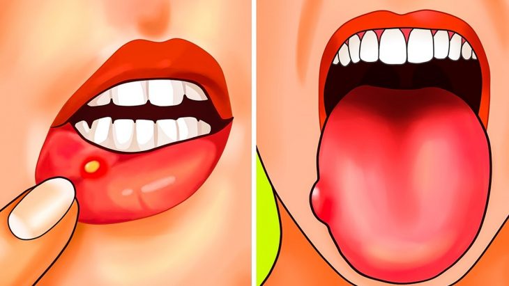 Дефицит фолиевой кислоты. 5 причин и 12 симптомов! Дефицит фолиевой кислоты. 5 причин и 12 симптомов!