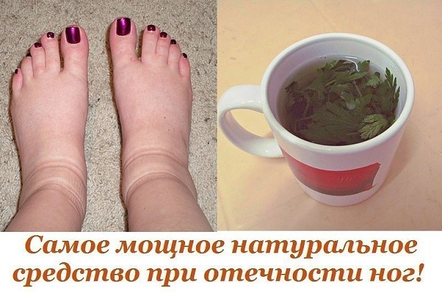 МОЩНОЕ НАТУРАЛЬНОЕ СРЕДСТВО ПРИ ОТЕЧНОСТИ НОГ!