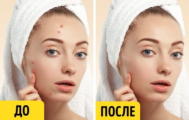 Волшебные масла, которые помогут поддержать естественную красоту