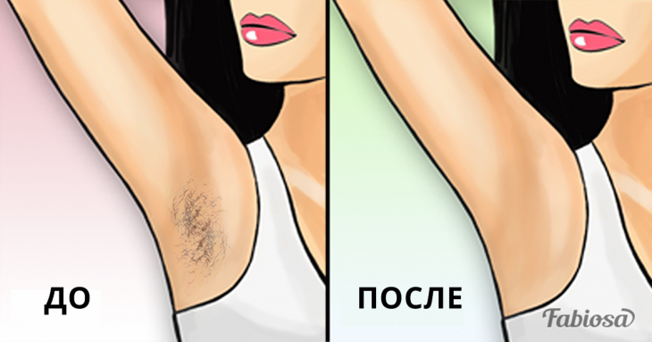 Вот 3 способа НЕ брить подмышки, но сделать их гладкими как фарфор Вот 3 способа НЕ брить подмышки, но сделать их гладкими как фарфор