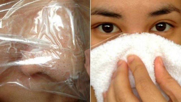 Быстро и бюджетно: избавляемся от черных точек