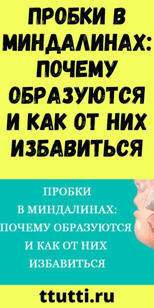 Пробки в миндалинах: Почему образуются и как от них избавиться