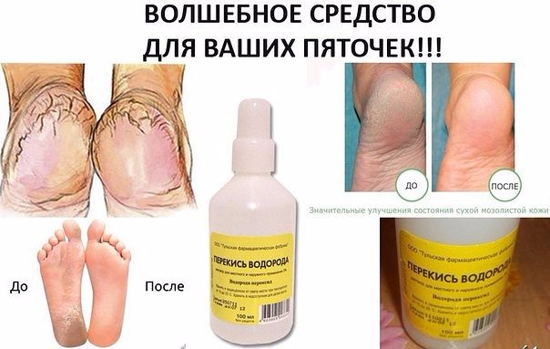 Польза массажа стоп