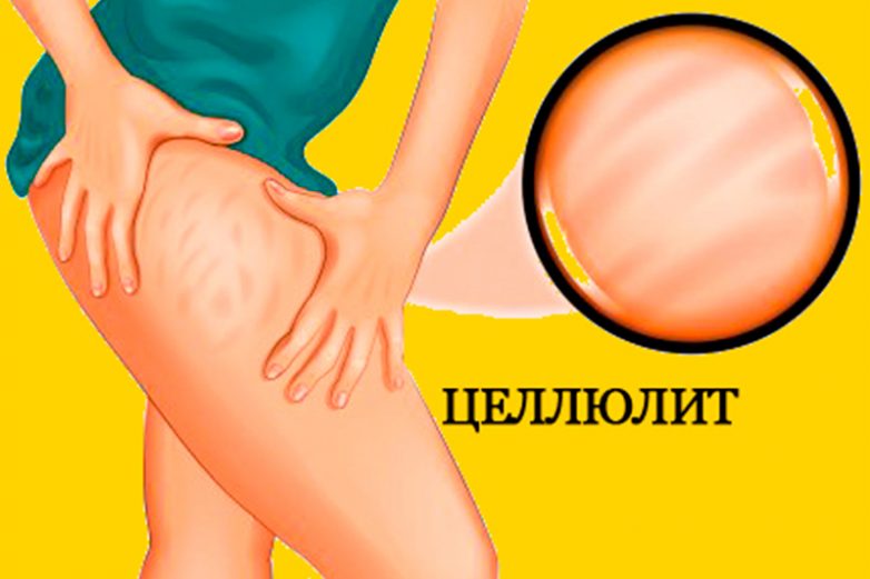Волшебное средство, которое плавит целлюлит