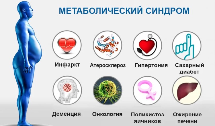 Как избавиться от метаболического синдрома, пока не поздно.