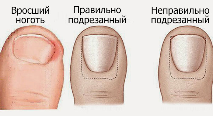 «Золотые» правила безупречного педикюра в домашних условиях! Лучше салонной процедуры!