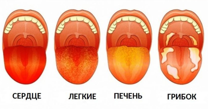 3 вещи, которые ваш язык пытается рассказать о вашем здоровье