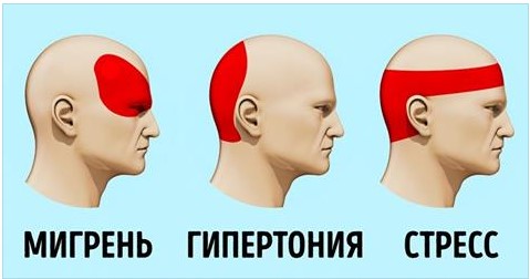 КАК ИЗБАВИТЬСЯ ОТ ГОЛОВНОЙ БОЛИ БЕЗ ТАБЛЕТОК ЗА 5 МИНУТ