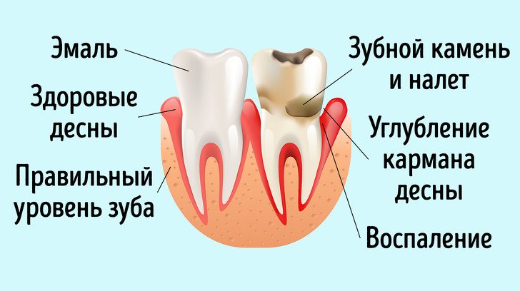 Признаки болезней сердца, которые видны невооруженным глазом