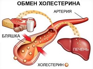 Что такое холестерин, и откуда берутся холестериновые бляшки?