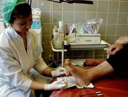 Синдром диабетической стопы