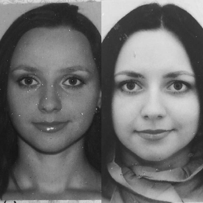 Отекает лицо по утрам? Лимфодренажная гимнастика для тела Отекает лицо по утрам? Лимфодренажная гимнастика для тела